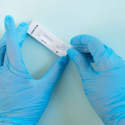 Test & Go: Officials Consider Replacing 2nd PCR Test with Antigen Test